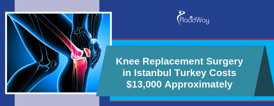 Knee Replacement Cost in Istanbul, Turkey
